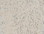 FH Recombinant antibody