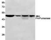 FH Recombinant antibody