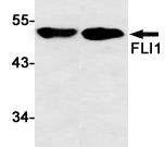 FLI1 Recombinant antibody
