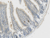 Glucocorticoid receptor Recombinant antibody