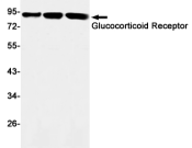 Glucocorticoid receptor Recombinant antibody