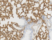 ICAM-1 Recombinant antibody