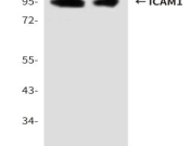 ICAM-1 Recombinant antibody