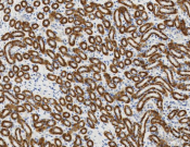 IDH2 Recombinant antibody