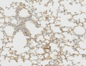 JNK Recombinant antibody