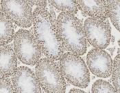 KHSRP Recombinant antibody