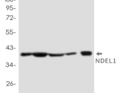 NDE1 Recombinant antibody