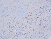 PAX6 Recombinant antibody