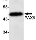 PAX6 Recombinant antibody