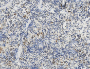 PIN1 Recombinant antibody