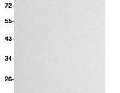 PIN1 Recombinant antibody