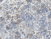 PRDX3 Recombinant antibody