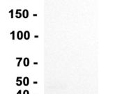 PRDX3 Recombinant antibody