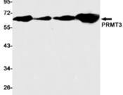PRMT3 Recombinant antibody
