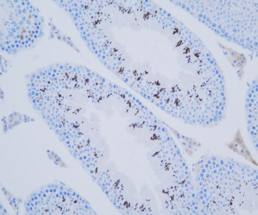 PRPH2?Recombinant antibody