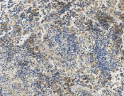 PSMD1?Recombinant antibody