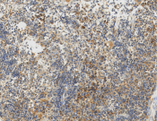 PSMD1?Recombinant antibody