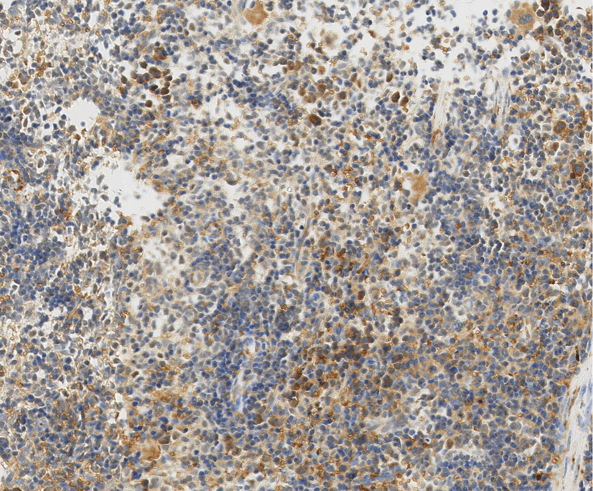 PSMD1?Recombinant antibody