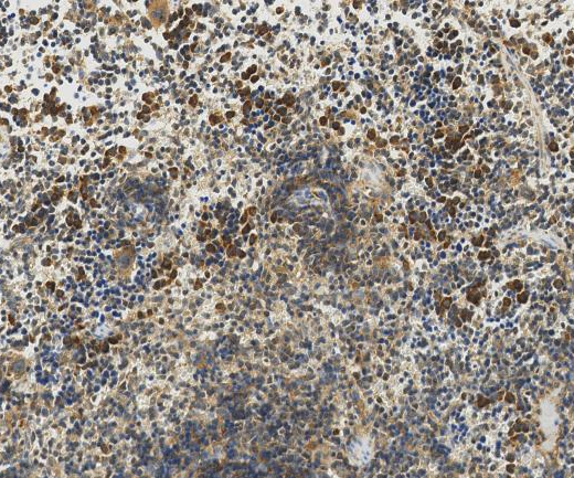 PSMD3?Recombinant antibody