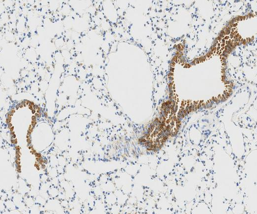 RPS11?Recombinant antibody