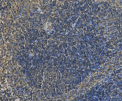 SCN4B?Recombinant antibody