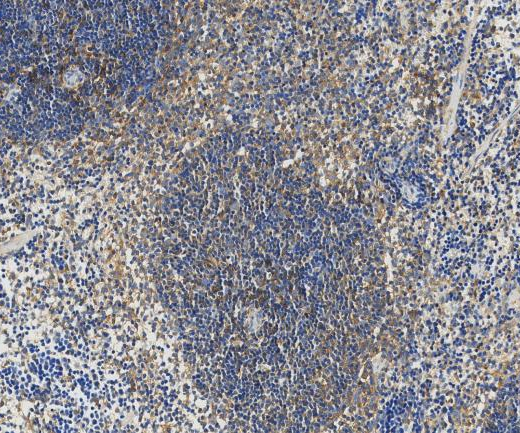 Septin 9?Recombinant antibody