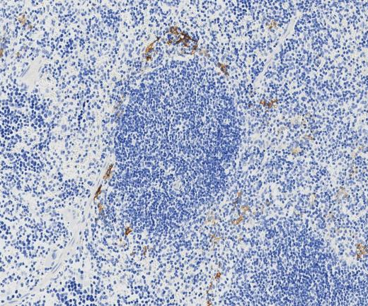 Surfactant protein D?Recombinant antibody