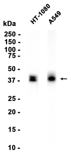 Cathepsin B Recombinant antibody