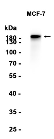 Carbonic Anhydrase II Recombinant antibody