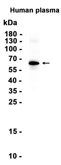 C8B?Recombinant antibody