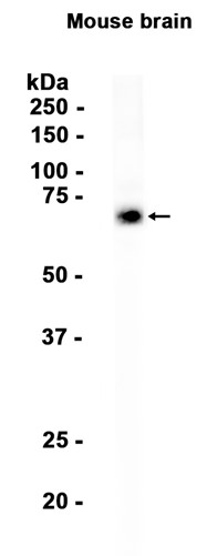 Acetylcholinesterase?Recombinant antibody