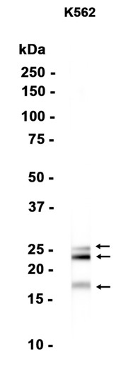 FGF2?Recombinant antibody