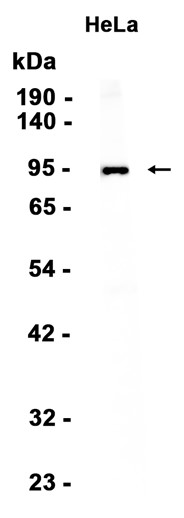 Insulin Receptor beta Recombinant antibody