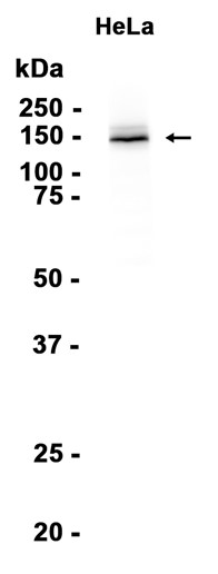 FANCI Recombinant antibody
