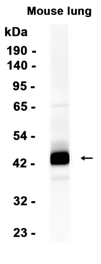 Haptoglobin Recombinant antibody