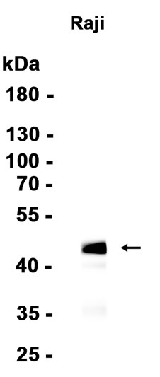 MEF2B Recombinant antibody