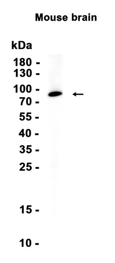 beta Catenin Recombinant antibody