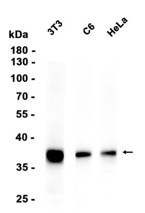 ATP6V0D1 Recombinant antibody