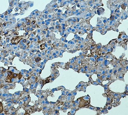 Toll Like Receptor 2 Recombinant antibody