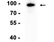 Toll Like Receptor 2 Recombinant antibody