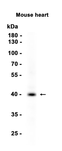 ATF1 Recombinant antibody