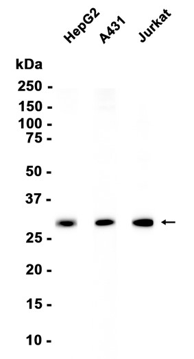 SDHB Recombinant antibody
