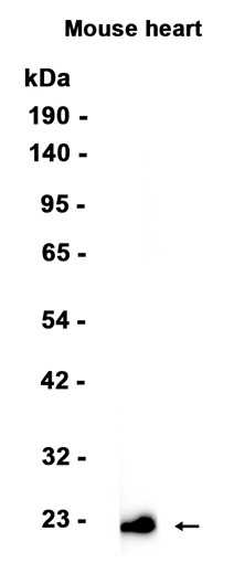Myosin light chain 3?Recombinant antibody