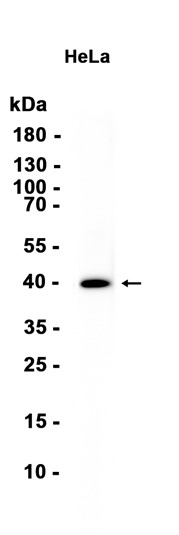 Aldolase A Recombinant antibody