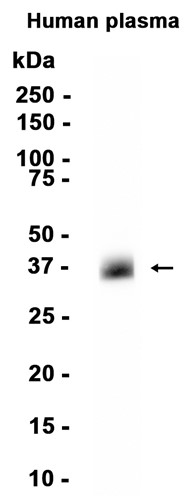 Apolipoprotein E Recombinant antibody