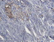 ERK1 Recombinant antibody