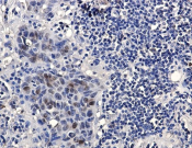 HMG4 Recombinant antibody