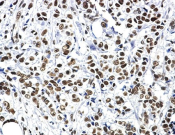 HSF1 Recombinant antibody