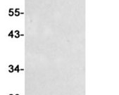 HSF1 Recombinant antibody