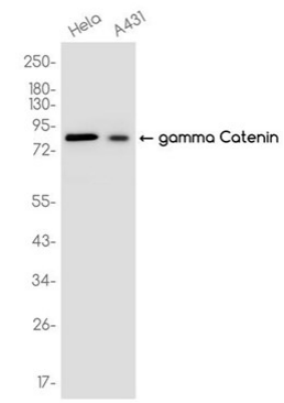 gamma Catenin Recombinant antibody